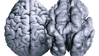 Los frijoles son útiles para la actividad cerebral